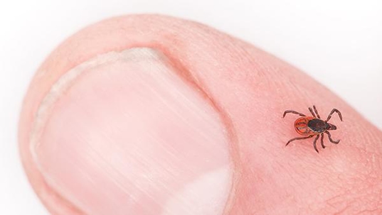 tick on finger