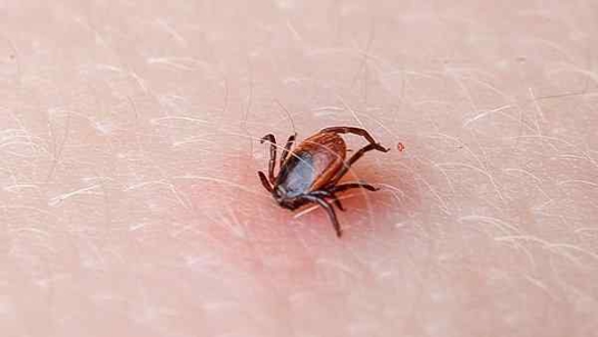 a deer tick embedded in human skin