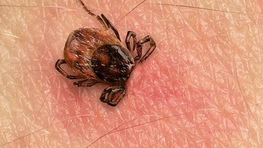 tick biting skin